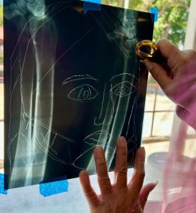 An x-ray, back lit, actively being etched.
